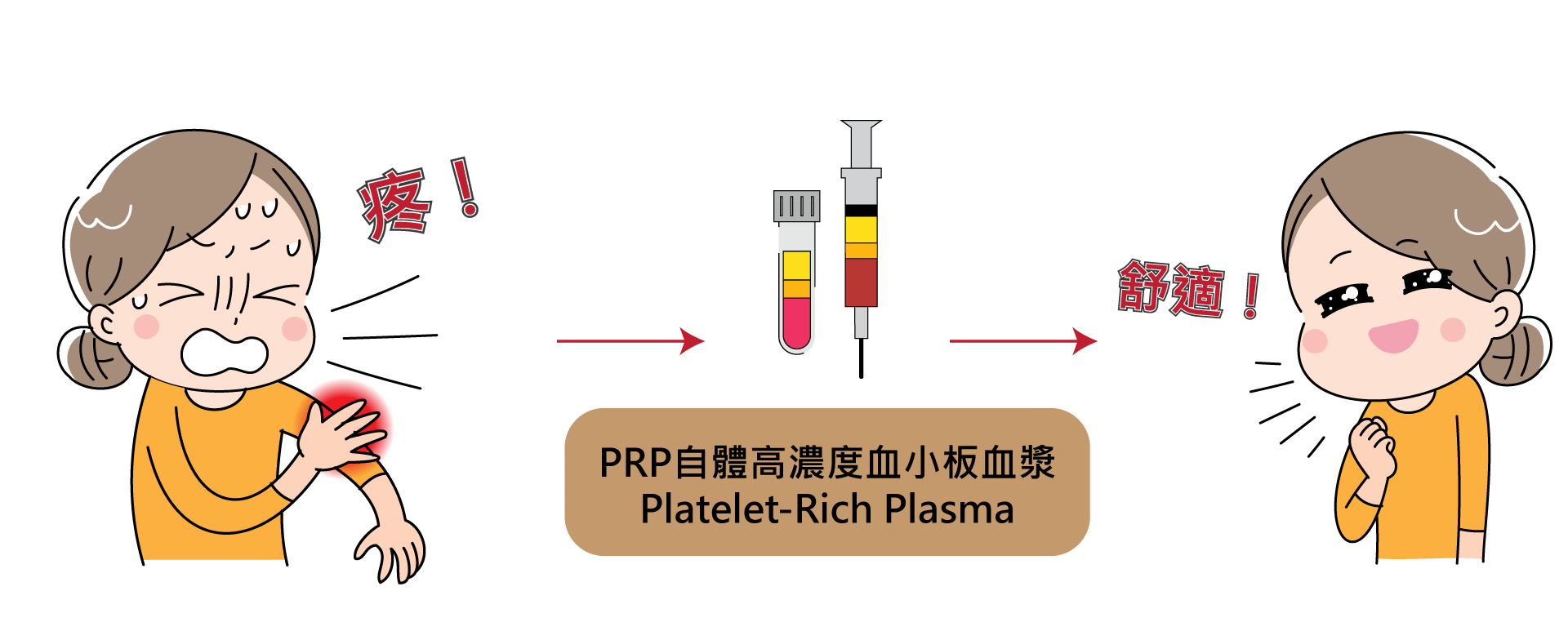 PRP注射 PRP注射