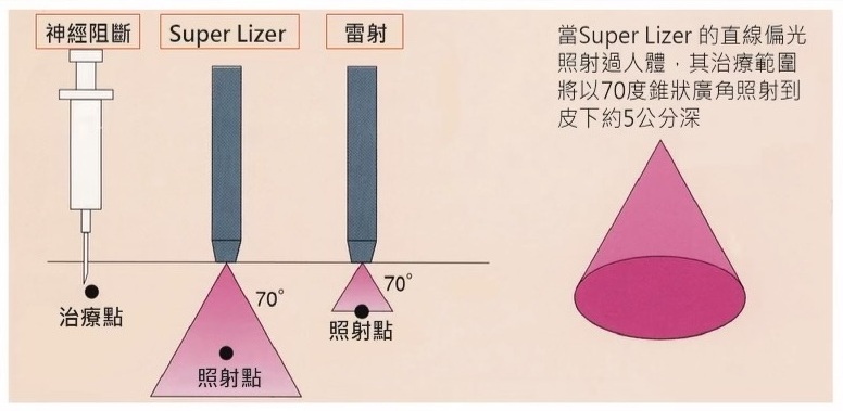 近紅外線優點 近紅外線照射更深更廣