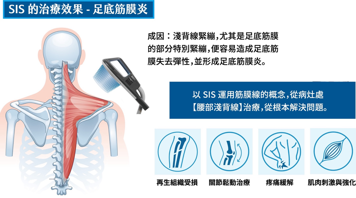 SIS 超磁場治療,肩頸酸痛,坐骨神經痛,下背痛,關節炎,腕隧道症候群,媽媽手,五十肩,肌筋膜疼痛,足底筋膜炎,肌肉強化,物理治療,復健 SIS 超磁場治療,肩頸酸痛,坐骨神經痛,下背痛,關節炎,腕隧道症候群,媽媽手,五十肩,肌筋膜疼痛,足底筋膜炎,肌肉強化,物理治療,復健
